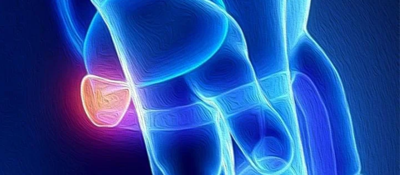 Leia mais sobre o artigo Vasectomia em Maceió: Como Funciona, Recuperação, Riscos e Custo